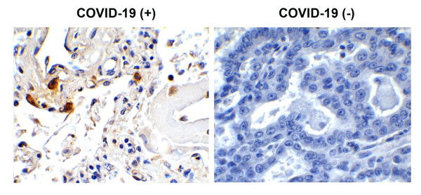 Anti-SARS-CoV-2 Envelope protein