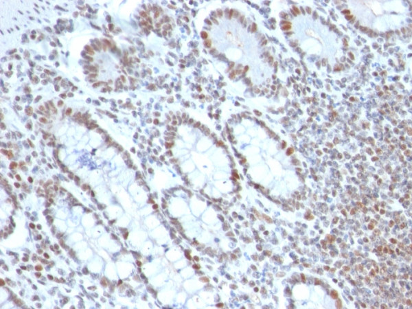 Anti-BMI1 (Oncogene and Stem Cell Marker), clone BMI1/2690
