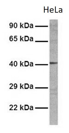 Anti-Fibromodulin