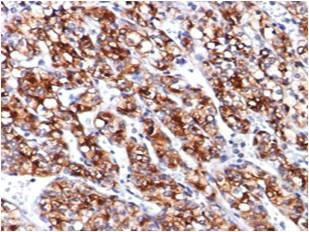 Anti-Renal Cell Carcinoma (Clone: 66.4.C2)