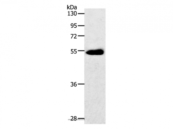 Anti-SLC2A3