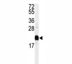 Anti-Calmodulin