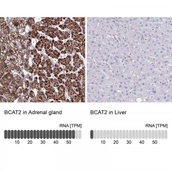 Anti-BCAT2