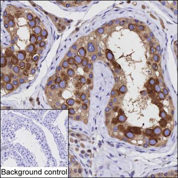Anti-HDAC6