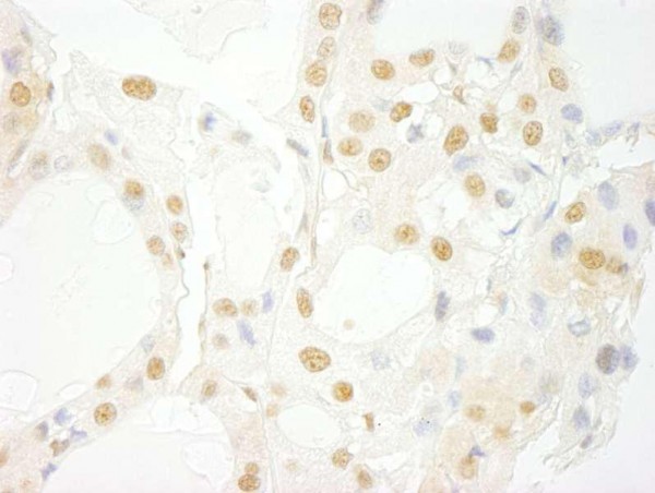 Anti-PRPF4B (IHC)