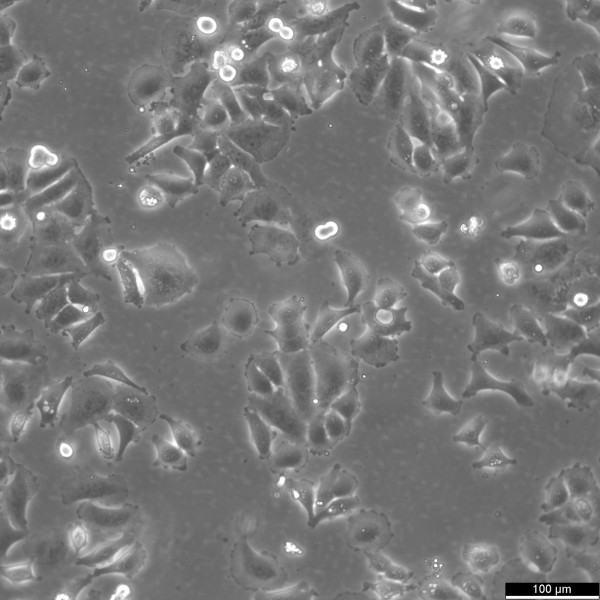 HCC1954 Cells