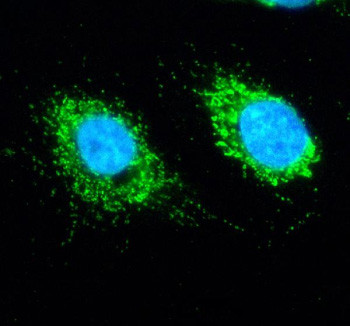 Anti-SLIRP / SRA stem-loop interacting RNA-binding protein