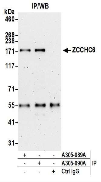 Anti-ZCCHC6