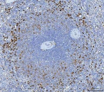 Anti-GZMK / Granzyme K