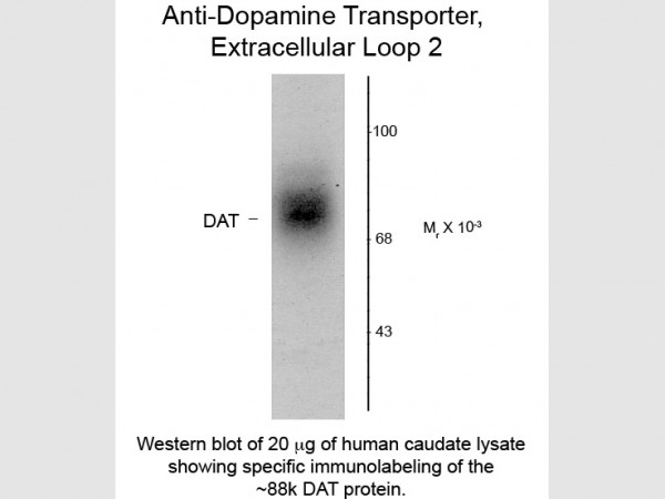 Anti-Dopamine Transporter