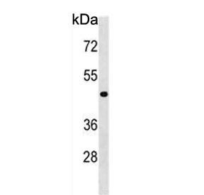 Anti-NME7 / Nucleoside diphosphate kinase 7