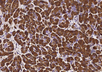 Anti-PNLIP Monoclonal Recombinant Antibody