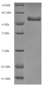Pro-neuregulin-3, membrane-bound isoform (NRG3),partial, human, recombinant