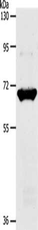 Anti-SLC33A1