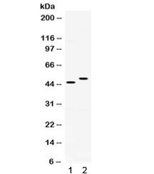 Anti-SLC10A1 / NTCP