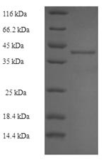 Ribosyldihydronicotinamide dehydrogenase [quinone] (Nqo2), mouse, recombinant
