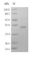Fc receptor-like protein 6 (FCRL6), partial, human, recombinant