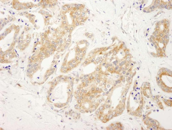 Anti-DDX6 (IHC)