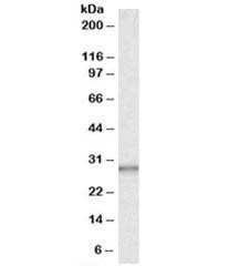 Anti-CA1