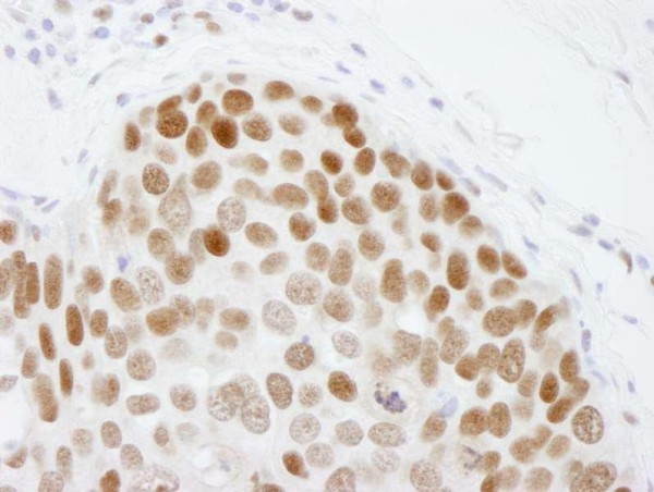 Anti-CBX3 (IHC)