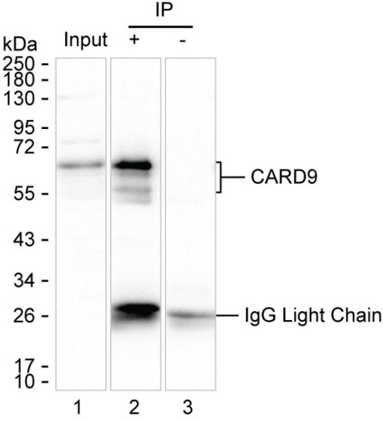 Anti-CARD9