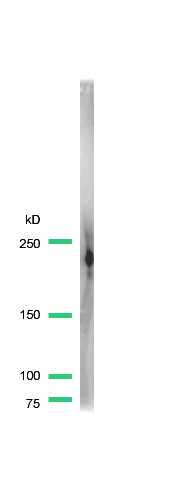 Anti-Dysferlin