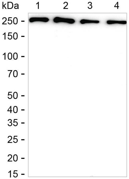 Anti-Fatty Acid Synthase (recombinant antibody)