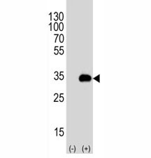 Anti-ATG-5