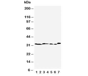 Anti-Caspase-6