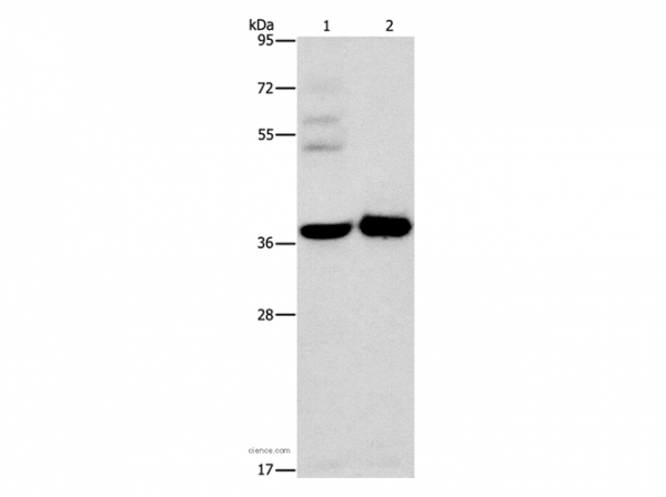 Anti-SERPINE2