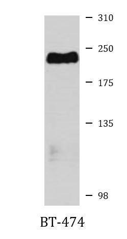 Anti-PBRM1 / Baf180