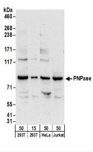 Anti-PNPase