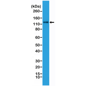 Anti-N-Cadherin (human), Rabbit Monoclonal (RM259)