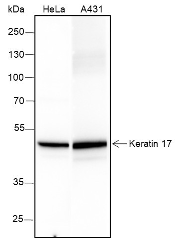 Anti-Recombinant Keratin 17, clone A275