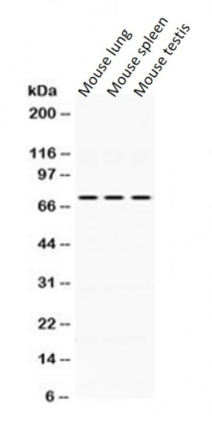 Anti-IL2 Receptor beta