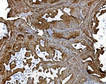 Anti-PDIR / Protein disulfide isomerase-related protein / PDIA5
