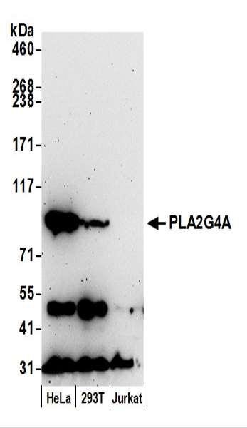 Anti-PLA2G4A/cPLA2