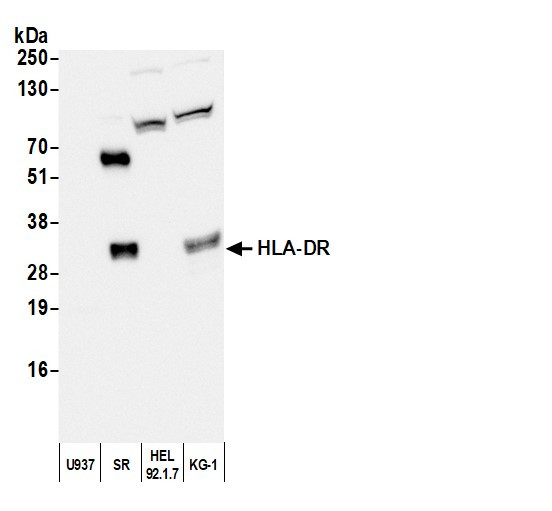 Anti-Mouse IgG2b, Biotin conjugated