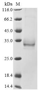 Erythropoietin receptor (Epor), partial, recombinant mouse