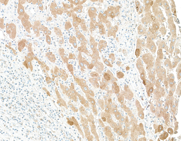 Anti-Human C-Reactive Protein (CRP)