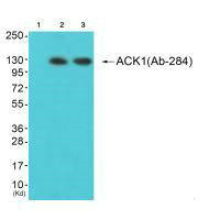 Anti-TNK2 (Ab-284)
