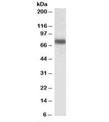 Anti-IRF2BP1
