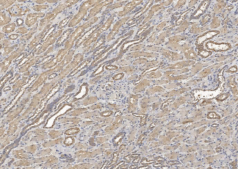 Anti-HGF Monoclonal Recombinant Antibody