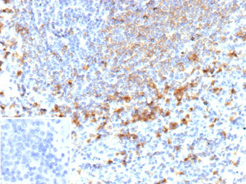 Anti-MMP9 / Matrix metalloproteinase 9, clone r15W2