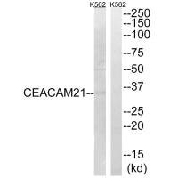 Anti-CEACAM21