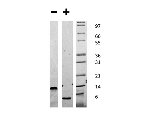 Epidermal Growth Factor