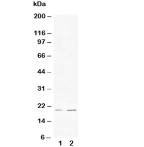 Anti-Bcl-XS