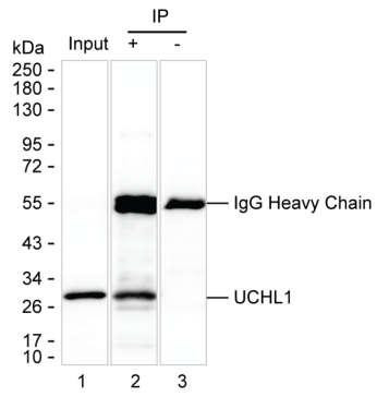 Anti-UCHL1