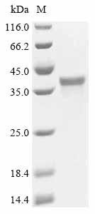 Spastin (SPAST), partial, human, recombinant