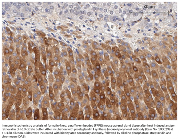 Anti-Prostaglandin I Synthase (mouse)